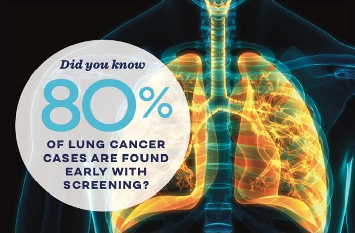 Did you know 80% of lung cancer cases are found early with screening?