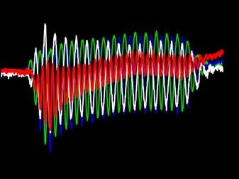 the Auditory Nerve Overlapped Waveform (ANOW). 