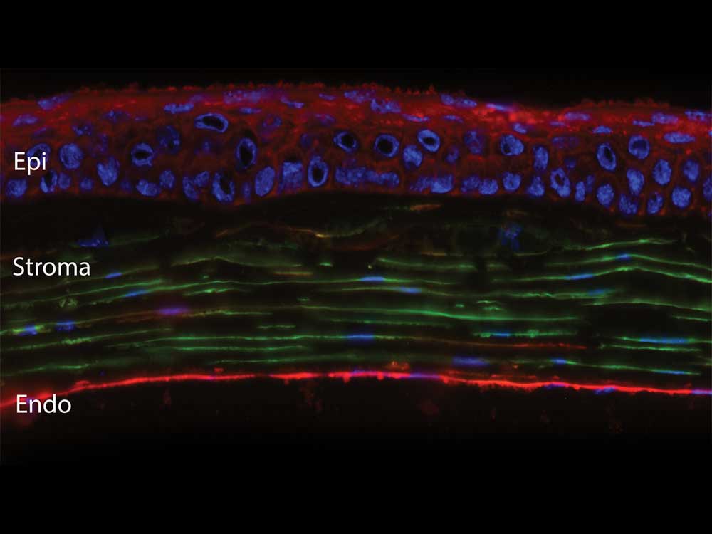 Espana Corneal Extracellular Matrix Laboratory