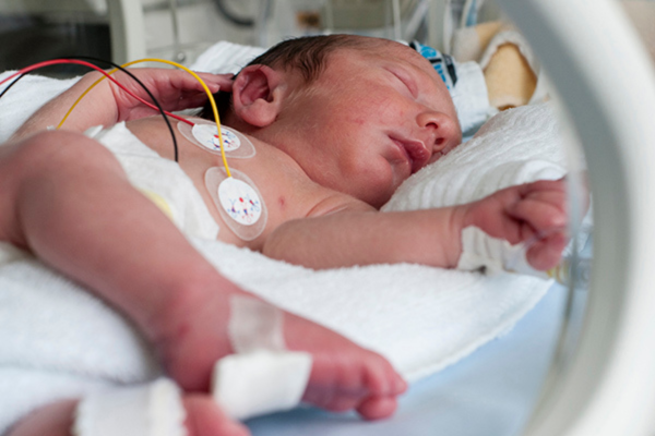 A baby in an incubator with wires attached to it.