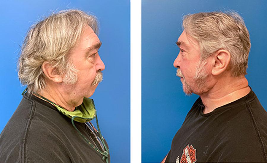 grateful patient Allen Parent