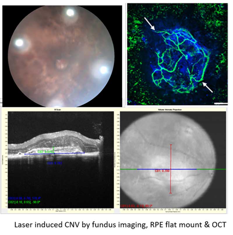 Laser induced CNV by fungus imaging, RPE flat mount& OCT