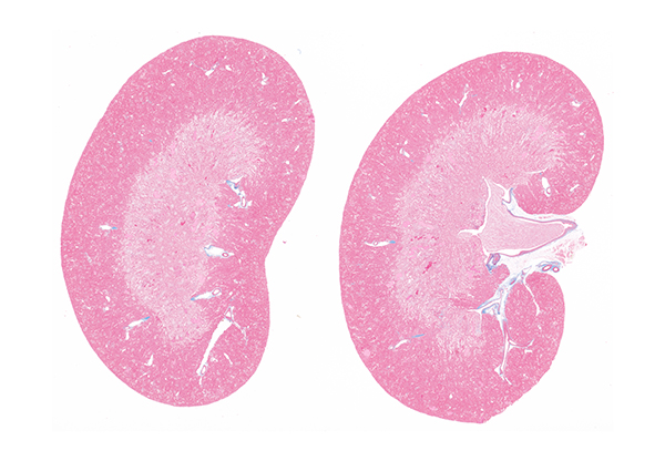 Kidneys illustration