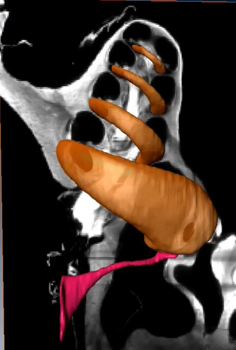 spatial origins along the cochlear length of otoacoustic emissions