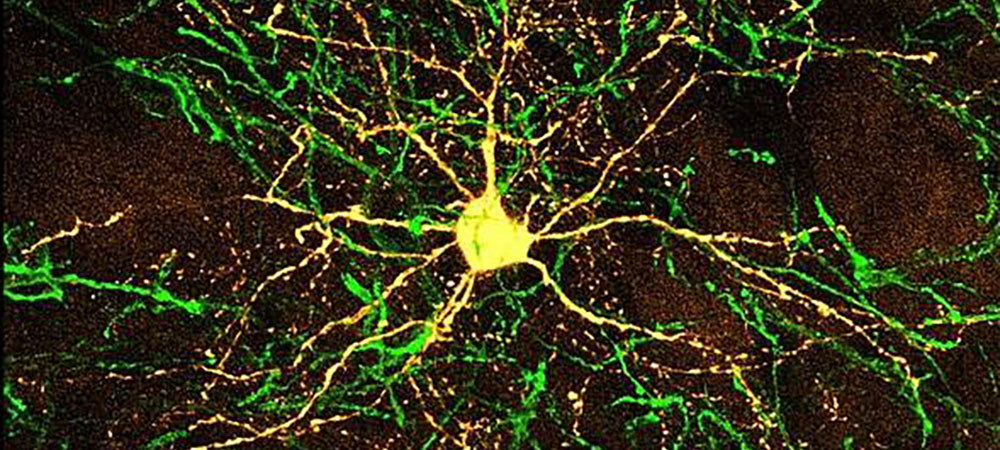 Striatal neuron in an interneuron cage