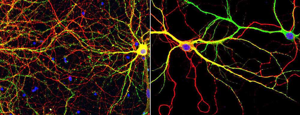 Hippocampal neurons in vitro labeled with MAP2 (green) and the nuclear DAPI stain. Left, tau (red). Right, phospho-tau (red).