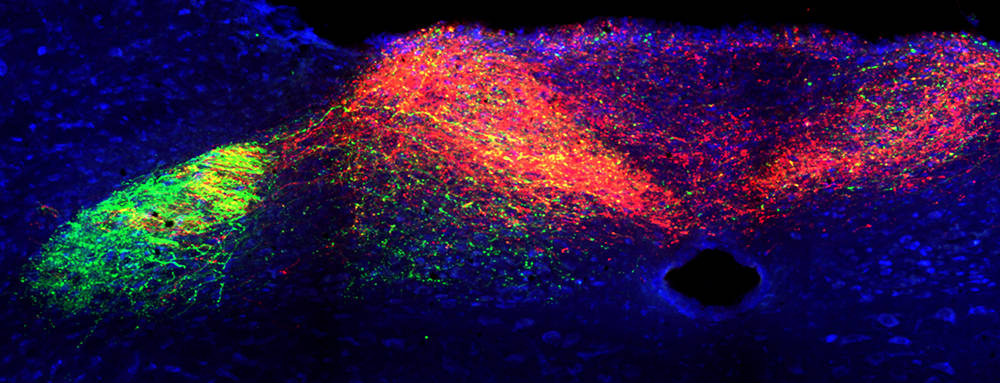 Central brainstem projections of distinct sensory subsets from the left vagal ganglia.