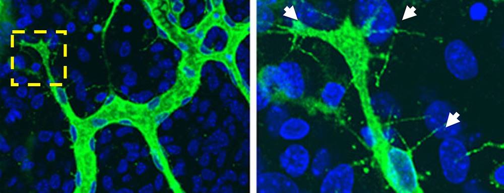 Heparan sulfate deficiency disturbs filopodia formation (white arrows) on vascular endothelial cells (green) on diaphragm.