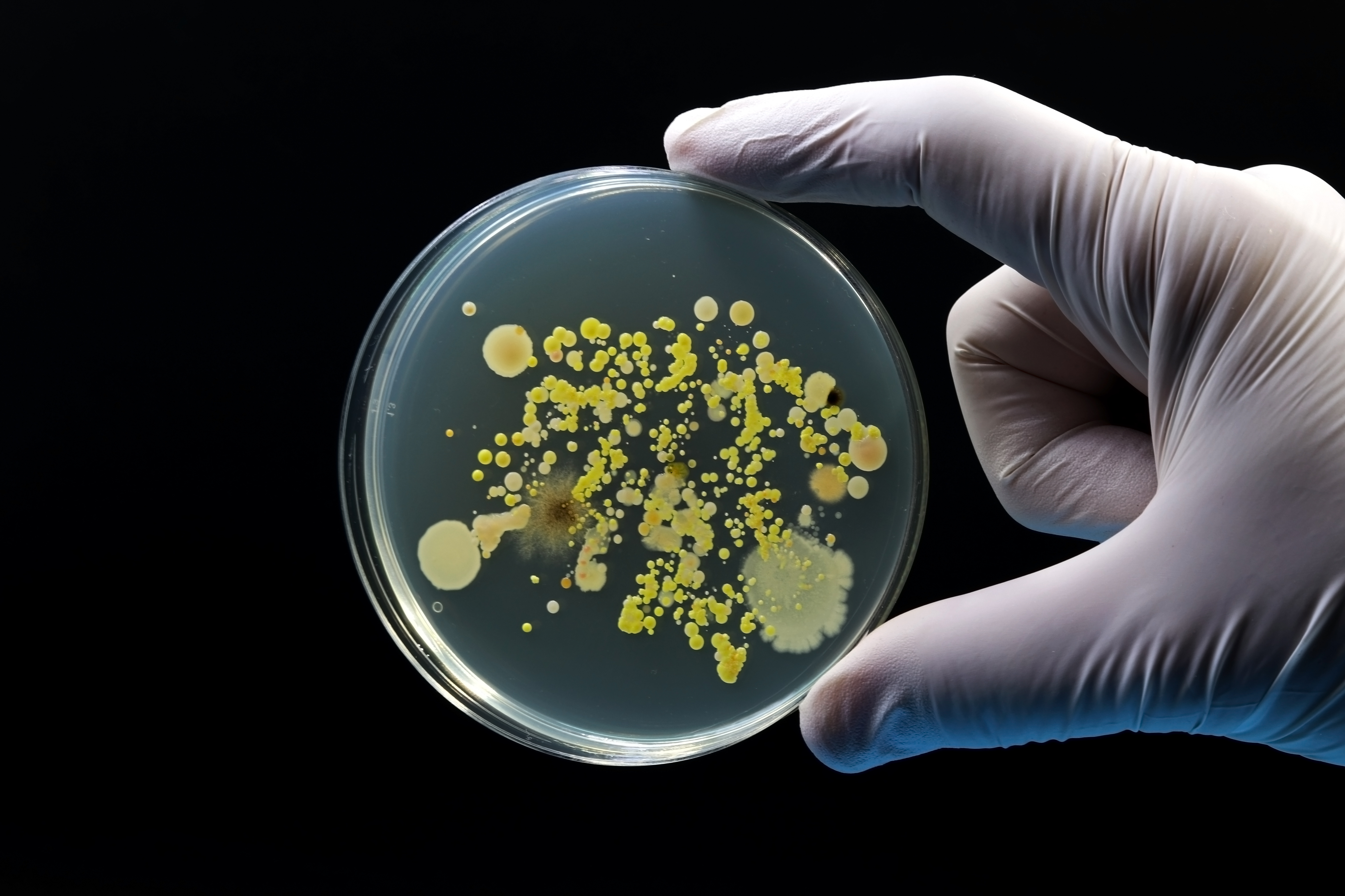 A gloved hand holds a petri dish containing various bacterial colonies growing on an agar medium. The colonies display different sizes, shapes, and colors, including yellow and cream tones, against a dark background. The image highlights microbial diversity and laboratory microbiology techniques.