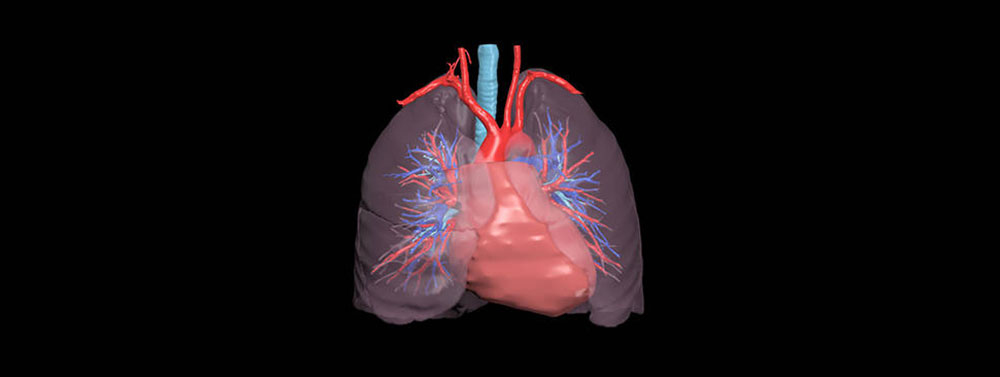 CT-derived 3D lung model