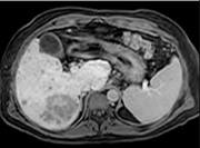 Body Imaging Fellowship MRI scan