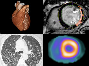 Cardiothoracic Imaging Fellowship