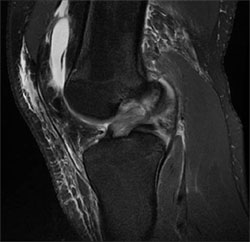 Musculoskeletal Imaging Fellowship