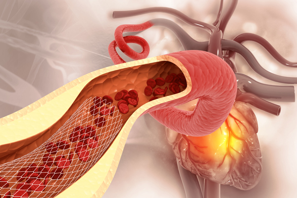 Vascular system 3D illustration