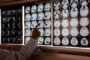 Neurology