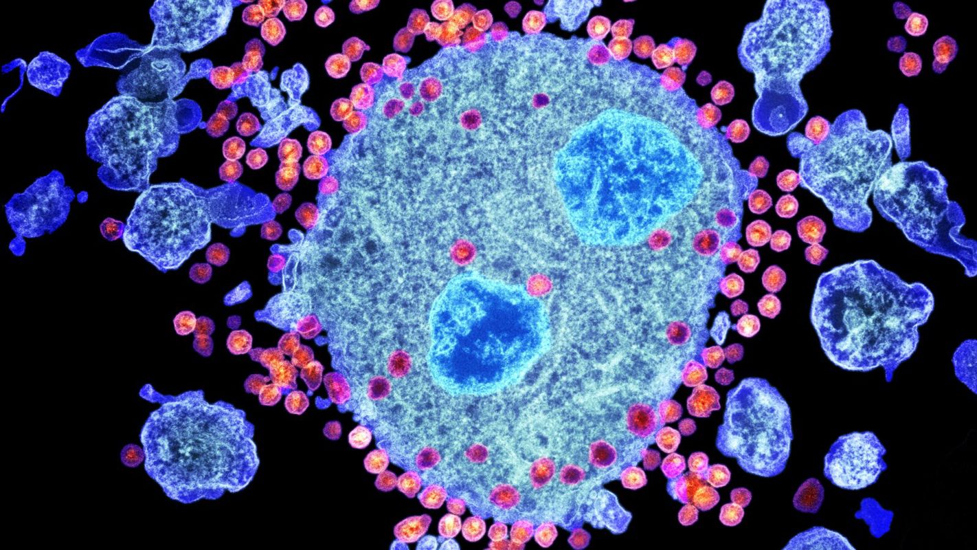budding HIV particles graphic