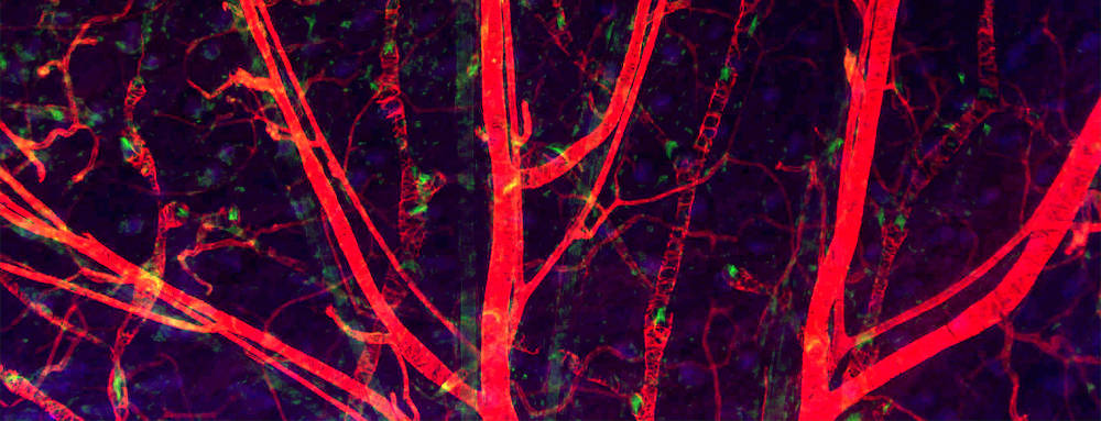 The network of blood (red smooth muscle cells) and lymphatic vessels with valves (green).