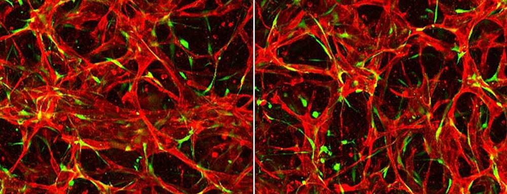 Human endothelial cells (red) and pericytes (green) self-assemble vascular capillaries in 3D culture.
