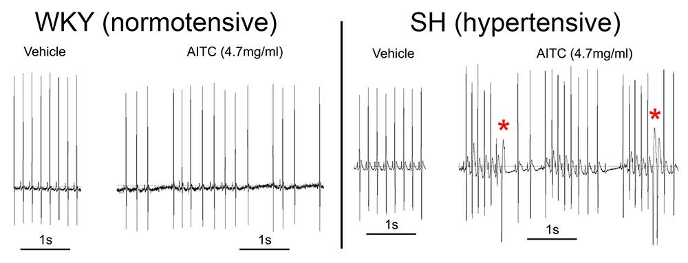 Inhalation of irritants (AITC) evoke distinct heart rhythms in normotensive and hypertensive rats.
