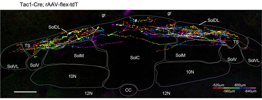 Central brainstem projections of peptidergic sensory nerves innervating the airways.