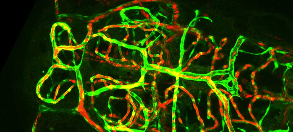 Zebrafish help to identify genetic causes of vascular disease