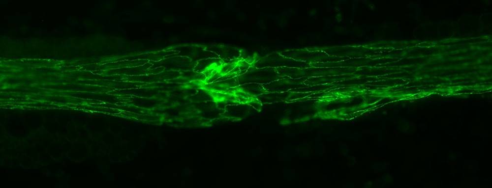 Lymphatic endothelial cells forming a lymphatic valve, stained for adherens junctional protein (green).