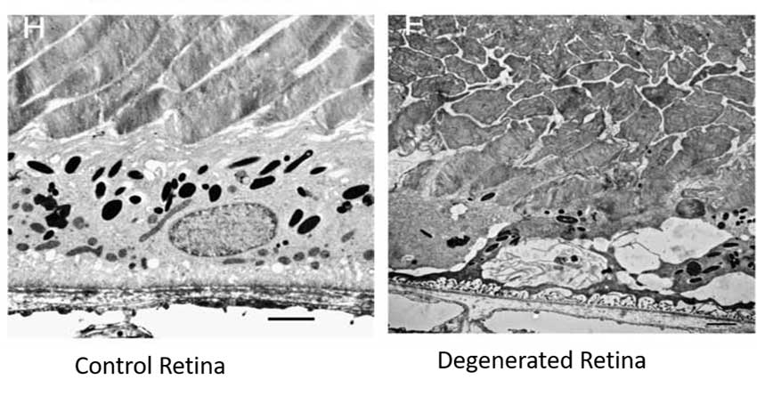Retinal degeneration control