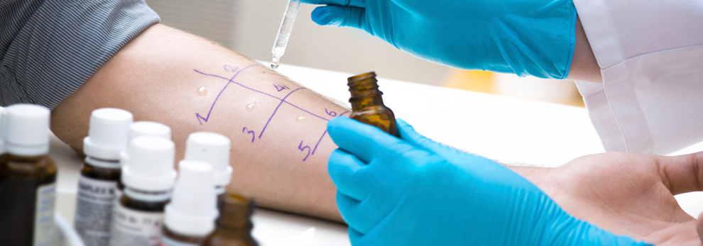 Patient being tested for various allergies during their doctor's appointment.