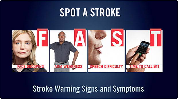 Spot a stroke F.A.S.T.