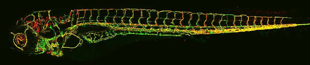Zebrafish helps identify genetic causes of vascular disease