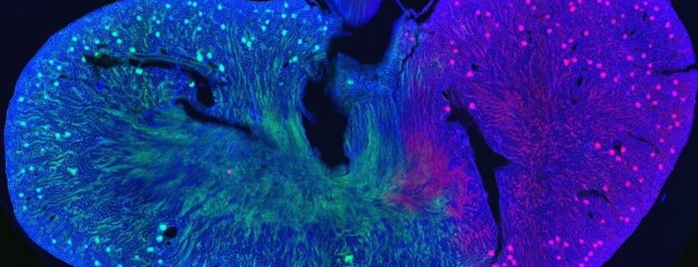 Vascular architecture of the kidney: upper (green) and lower (red) branches of the renal artery.