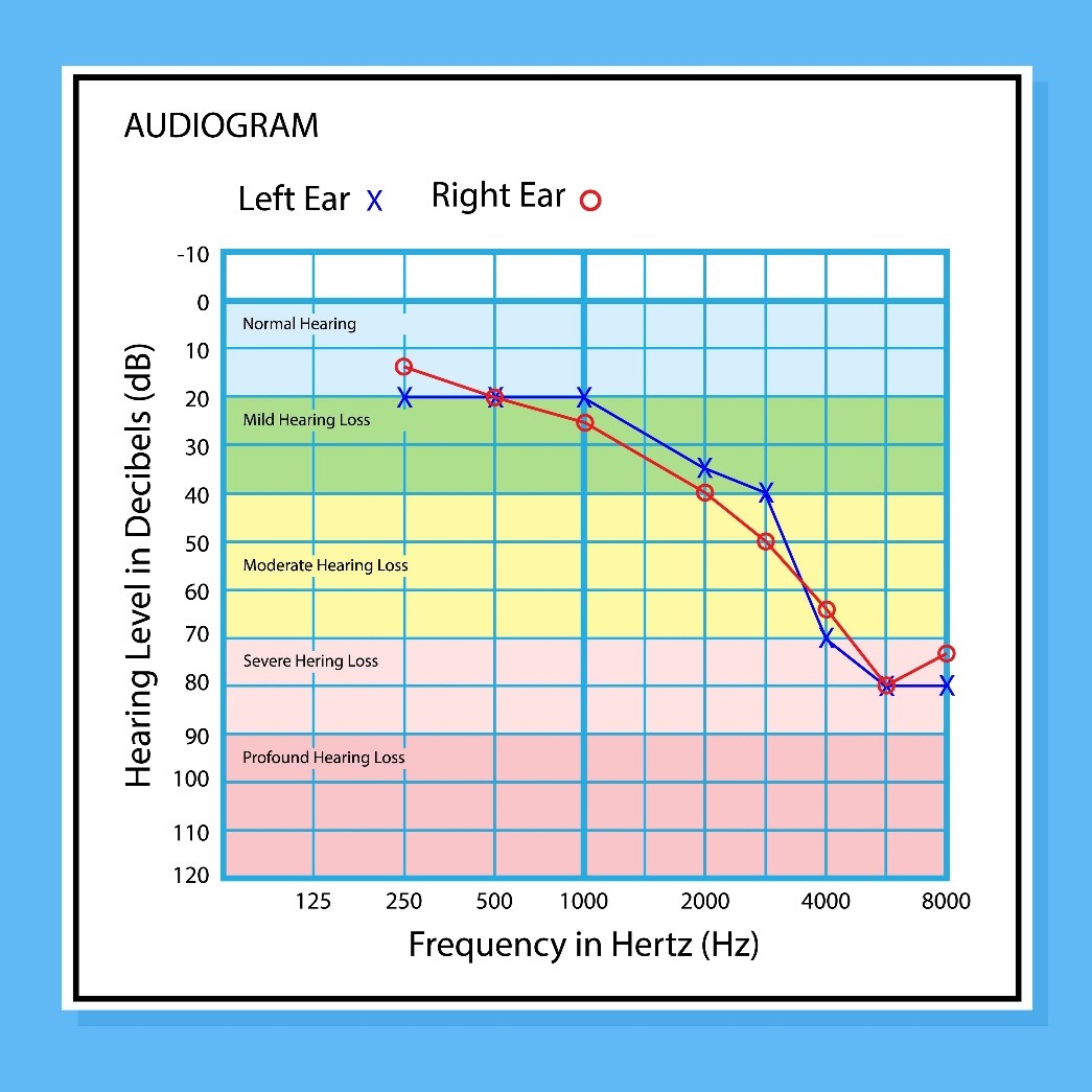 audiogram chart