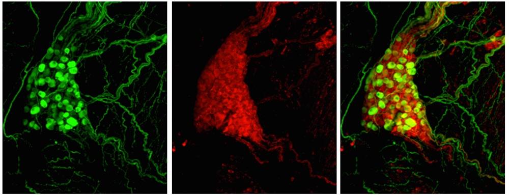 Pulmonary vein ganglion on the heart containing sympathetic (green) and parasympathetic (red) neurons.